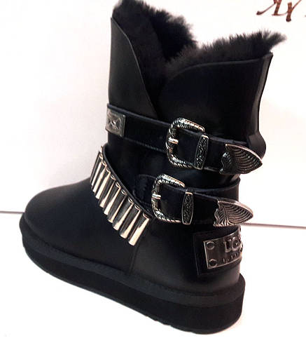 Customizable uggs top