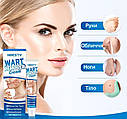 Косметичний крем для усунення папілом та бородавок Wart Remover Cream, фото 4