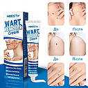 Косметичний крем для усунення папілом та бородавок Wart Remover Cream, фото 5