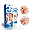 Косметичний крем для усунення папілом та бородавок Wart Remover Cream, фото 3