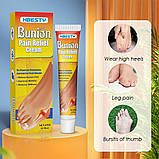 Крем для суглобів від вальгусної деформації Bunion Pain Relief Cream, фото 5