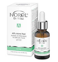 Пілінг для жирної змішаної шкіри з акне - 42% Anti Acne Peel With Azelaic Mandelic And Salicylic Acid, 30 мл