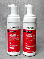 Revuele Пінка для вмивання обличчя проти прищів, 150 мл