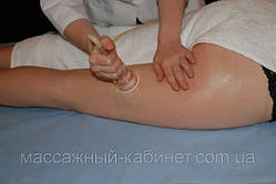 Вакуумно-банковий масаж (апаратний) 45 хв