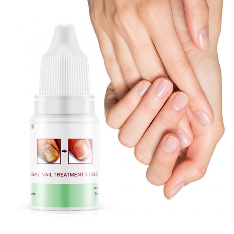 Відновлюючий крем для нігтів Omy Lady Fungal Nails Treatment, 5мл kitty.in.ua, фото 1