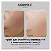 Крем для обличчя з пептидами та вітамінним комплексом - Medi peel Peptide 9 Vitanol Cream Pro, 50 мл, фото 3