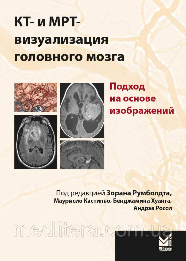 Румболдт, Кастільо, Хуанг КТ - і MPT - візуалізація головного мозку. Підхід на основі зображень 2016 рік