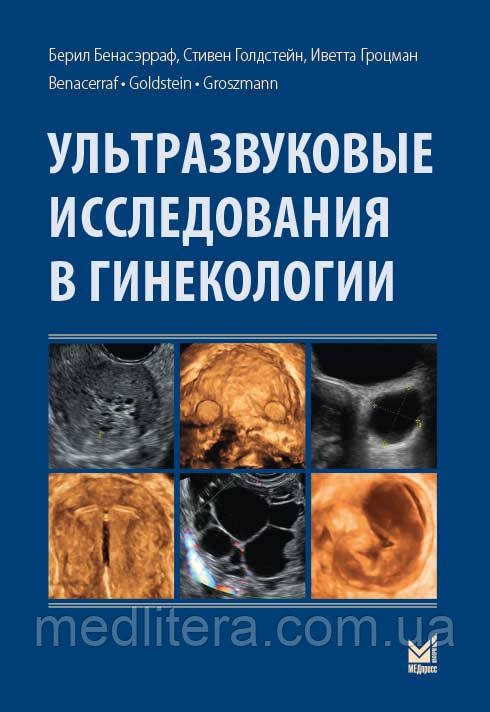 Бенасэрраф Б. Ультразвукові дослідження в гінекології 2016 рік
