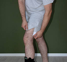 Адаптивні шорти (труси) трикотаж меланж