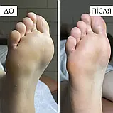 PNB Professional Пінка PedicureFoam для розм’якшення ороговілої шкіри на стопах ПедикюрФоам, 150 мл, фото 2