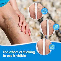 Пластир від варикозу