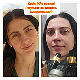 Крем-гель для шкіри навколо очей з біозолотом, Джерелія, 30 мл, фото 10