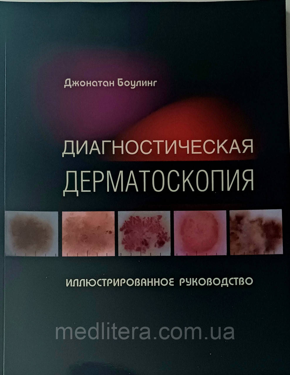 Боулінг Діагностична дерматологія.