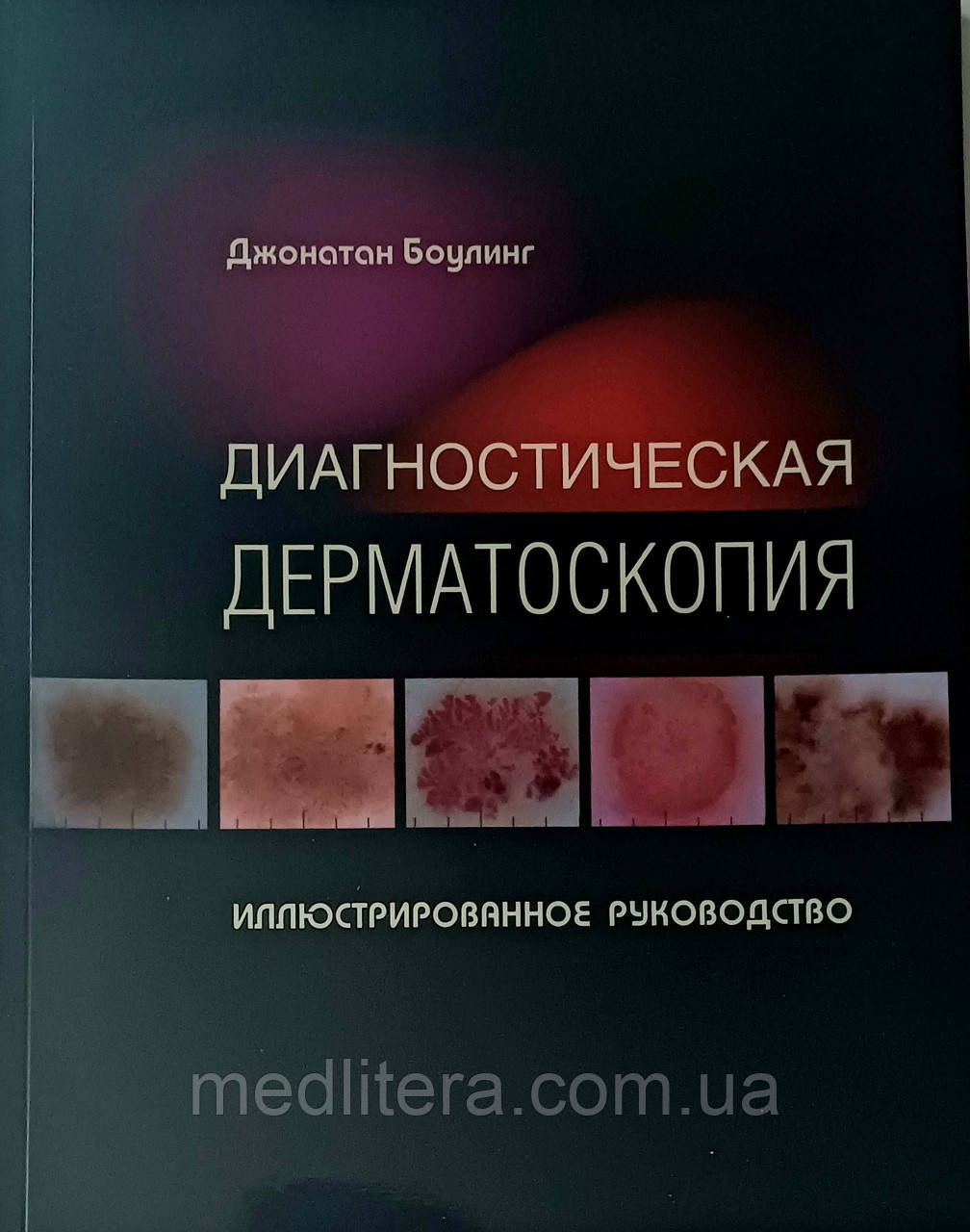 Боулінг Джонатан Діагностична дерматоскопія. Ілюстроване керівництво