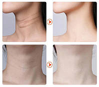 Мікрострумовий масажер для шиї та обличчя Neck Beauty Device, фото 5