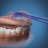 Насадка-ложка для чищення язика Waterpik TC-70E, фото 2