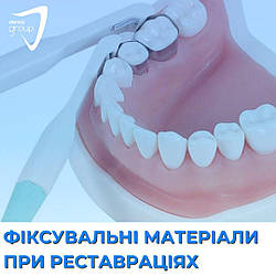Фіксувальні матеріали при реставраціях