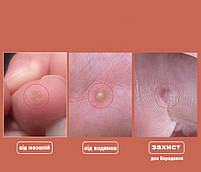 Самоклеючі захисні шайби від мозолів овальна форма 1 пластина 15шт. Захисні пластирі від мозолів., фото 3