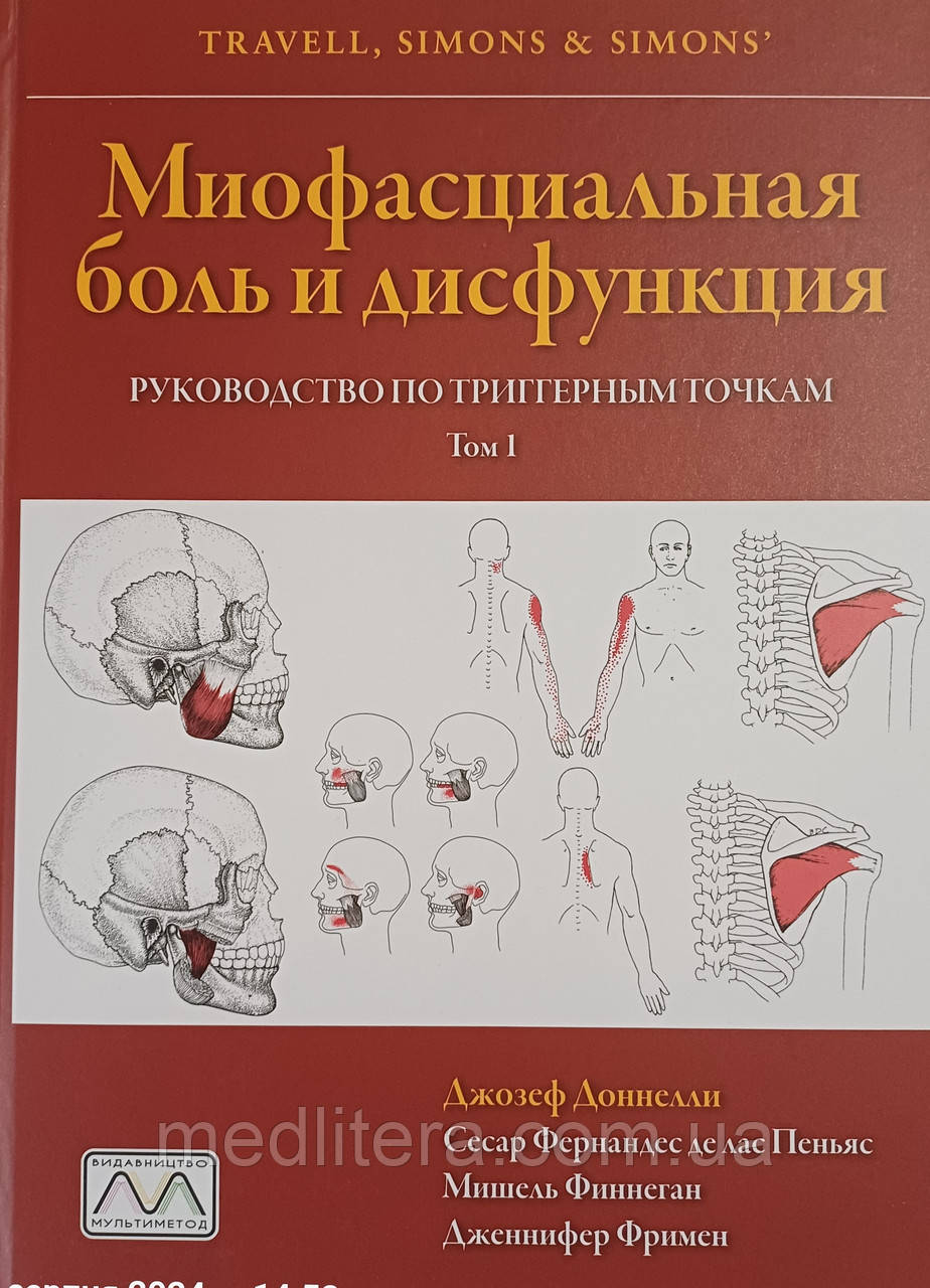 Доннеллі Міофасціальний біль і дисфункція у 2 томах Посібник по тригерних точках»., фото 1