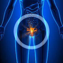 TVT-O операція