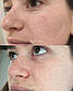 Сироватка з ніацинамідом Dr Barbara Sturm The Better B Niacinamide Serum 10 мл, фото 3