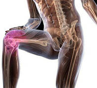 Препараты для здоровья суставов и костей