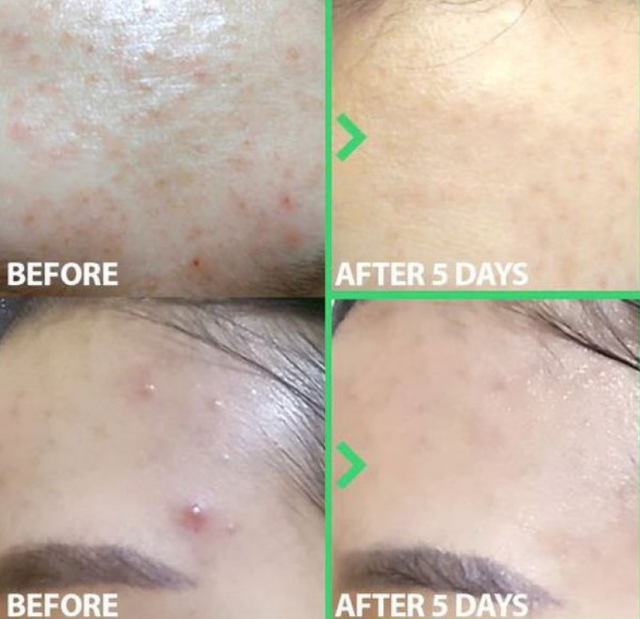 Заспокійлива сплеш-маска для проблемної шкіри Blithe Soothing&Healing Green Tea Splash Mask