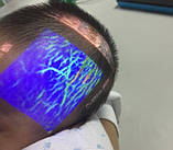 Система кольорової візуалізації вен портативна Медапаратура, фото 8