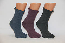 Жіночі шкарпетки махрові діабетичні STYLE LUXE асорті