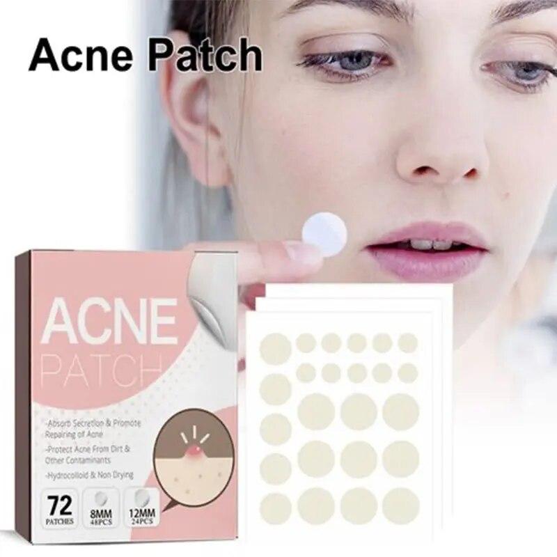 Патч гідрогелевий The Look Of Comedo Acne Skin Tag Patches від вугрів, акне, прищів, бородавок, комедон 72 шт., фото 1