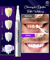 Набір для вибілювання зубів DENTELO 32 LED з 3 олівцями для вибілювання зубів — 20 сеансів вибілювання, фото 4