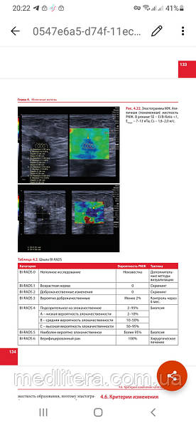 Ультразвуковая эластография. От простого к сложному Сенчу А.М. 2023 год, фото 0