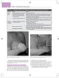 Основи мамографії С. Уильямс, К. Тейлор, С. Кэмпбелл 2024 рік 200 иллюстрацій, фото 6