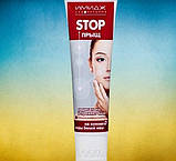 Stop- прищ "Імідж Лабораторія" на основі кори білої верби для догляду за шкірою під час гнійничкових уражень., фото 3