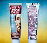 Stop- прищ "Імідж Лабораторія" на основі кори білої верби для догляду за шкірою під час гнійничкових уражень., фото 5