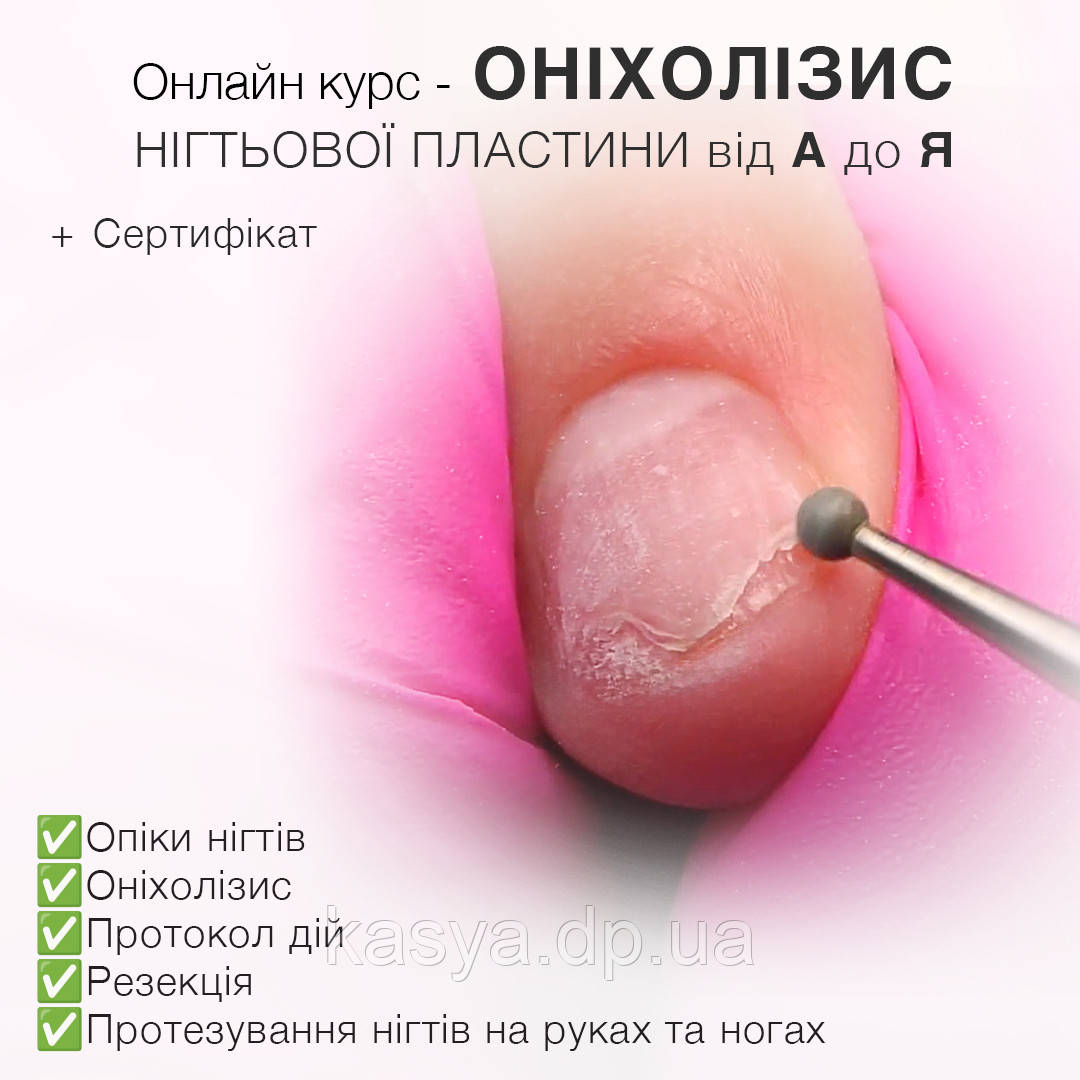 🔴 КУРС "ПРО ОНІХОЛІЗІС ВІД А ДО Я" 🔴 ⠀