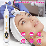 Ручка для видалення тегів шкіри Augo, професійний набір ручок для видалення родимок Портативна акумуляторна ручка для видалення шк, фото 2