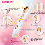 Ручка для видалення тегів шкіри Augo, професійний набір ручок для видалення родимок Портативна акумуляторна ручка для видалення шк, фото 4