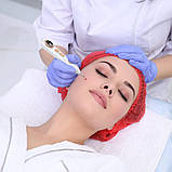 Ручка для видалення тегів шкіри Augo, професійний набір ручок для видалення родимок Портативна акумуляторна ручка для видалення шк, фото 5