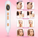 Ручка для видалення тегів шкіри Augo, професійний набір ручок для видалення родимок Портативна акумуляторна ручка для видалення шк, фото 6