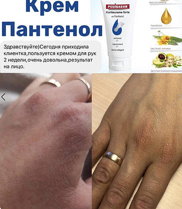 КРЕМ З ПАНТЕНОЛОМ ДЛЯ НІГ 500 МЛ (KARITECREME FORTE), PEDIBAEHR, фото 3