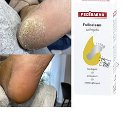 БАЛЬЗАМ З ПЕРЕПОЛІСОМ ДЛЯ НІГ 500 МЛ (FUSSBALSAM), PEDIBAEHR, фото 3