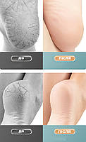 Шкарпетки для п'ят від тріщин чорні універсальний. Силіконові шкарпетки накладки на п'яти, фото 5