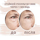 Кинезио тейп для обличчя ARES Beauty (Південна Корея), фото 9
