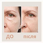 Кінезіотейп для обличчя RockTape Beauty Hemp (CША) Натуральний, фото 5