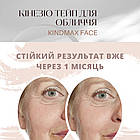 Кінезіотейп для обличчя Kindmax Face Tape Half Бежевий 2,5 см х 10 м, фото 4
