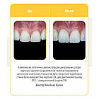 Transcend (Трансценд) шприц 4г, EW Ultradent, фото 7