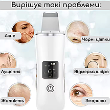 Ультразвуковий ефективний скрабер для обличчя Swan MSY-C7 ліфтинг та омолодження шкіри з іонізацією білий, фото 3