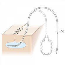 Дренажні системи