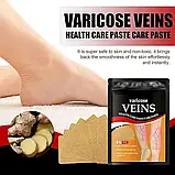 Пластир проти варикозного розширення вен (12 шт.) Veins Patch Бежеві SV227, фото 3